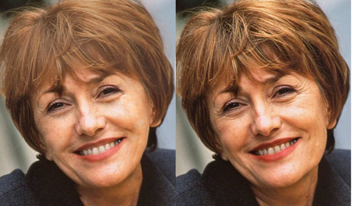 कंटूरिंग से पहले और बाद में चेहरे की तस्वीर